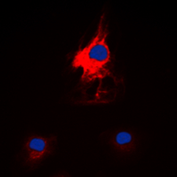HARS Antibody
