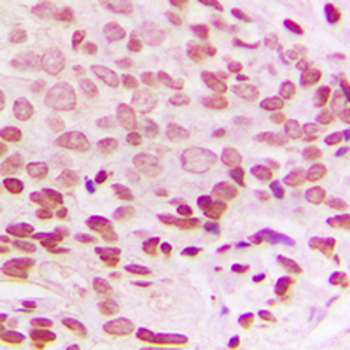 Histone H1.0 Antibody