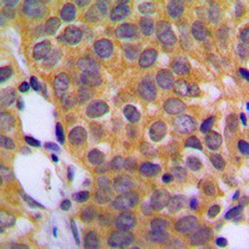 DUSP1 Antibody