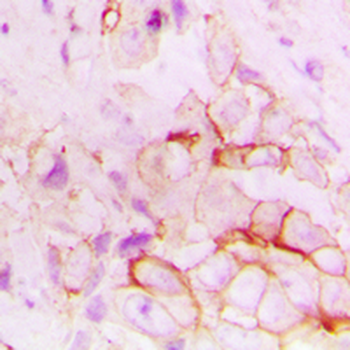 CD143 Antibody