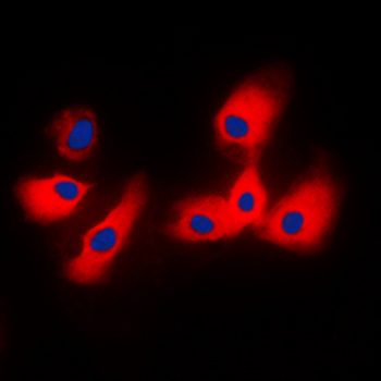 Cytochrome P450 2A6 Antibody