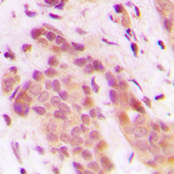CDK8 Antibody
