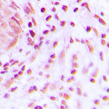 BARD1 Antibody