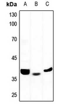 ALDOB Antibody
