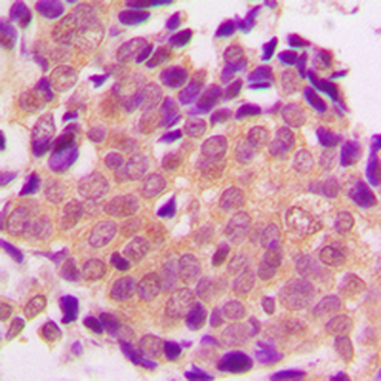 ALDOB Antibody