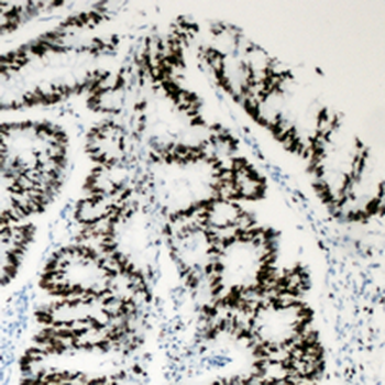 BAF53A Antibody
