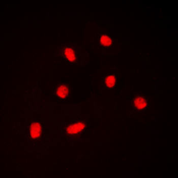 BAF53A Antibody
