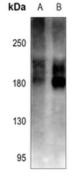 Cav1.2 Antibody