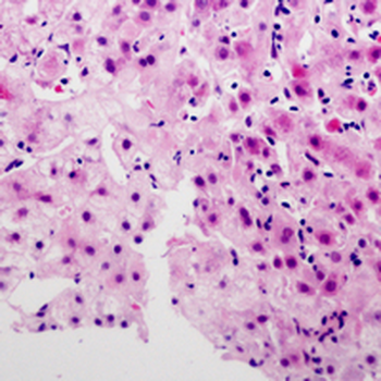 SERINC2 Antibody