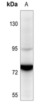 SENP5 Antibody