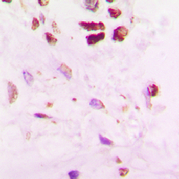 SENP5 Antibody