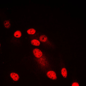 SYNE3 Antibody