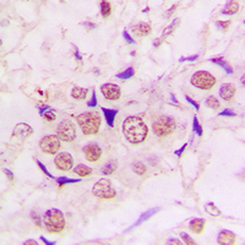 ZC3H8 Antibody