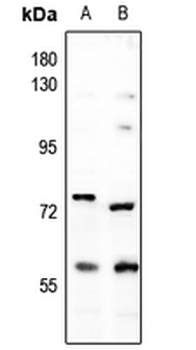 DCLRE1B Antibody