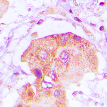 EPS8L2 Antibody