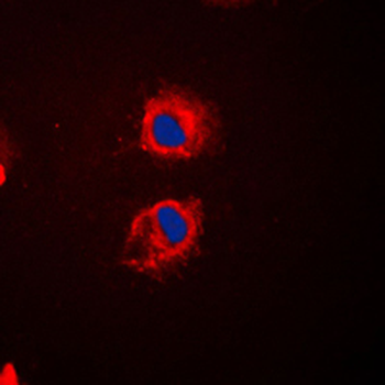 EPS8L2 Antibody