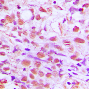 SENP2 Antibody