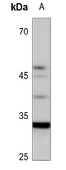 UBFD1 Antibody
