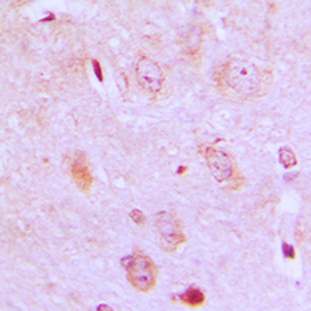 IARS2 Antibody