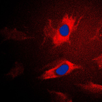 IARS2 Antibody