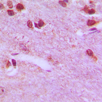 RPL26L1 Antibody