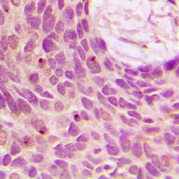 SENP1 Antibody