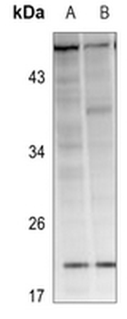 RAB38 Antibody