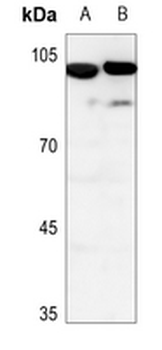 PIP5K1C Antibody