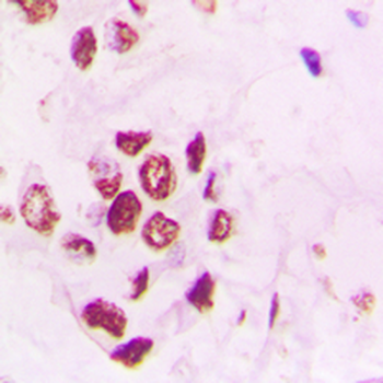 PIAS3 Antibody