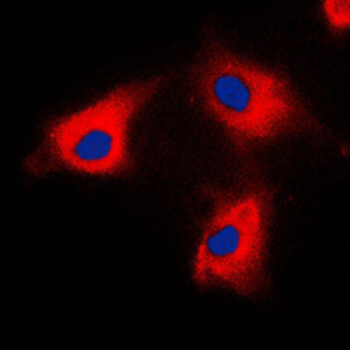 BCKDK Antibody