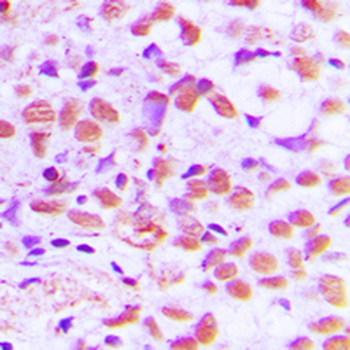SAE1 Antibody