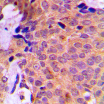 UBA2 Antibody