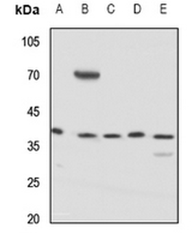 KCNAB3 Antibody