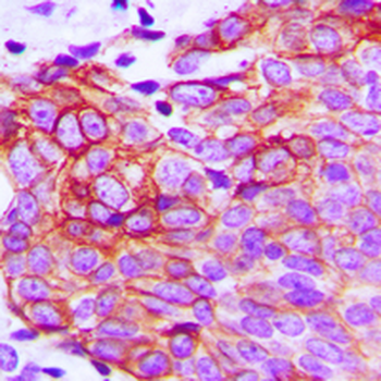 Claudin 1 Antibody
