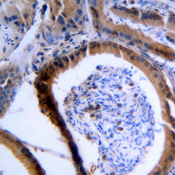 VASP Antibody