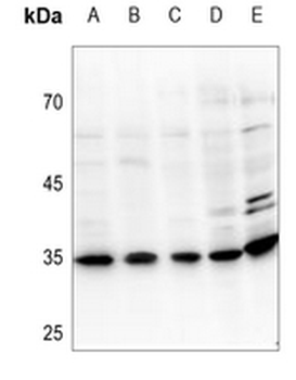 UDG Antibody