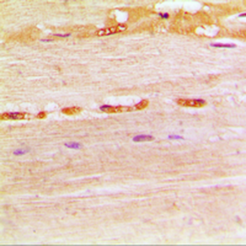UDG Antibody