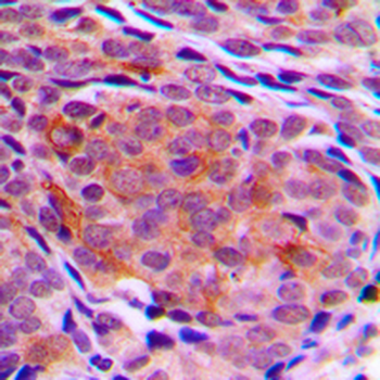 TCTP Antibody