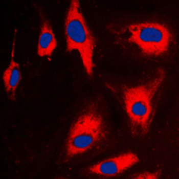 TCTP Antibody