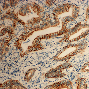 Tetraspanin 8 Antibody