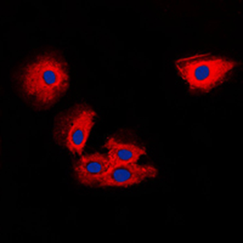 TIMP2 Antibody
