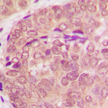 STAT6 Antibody