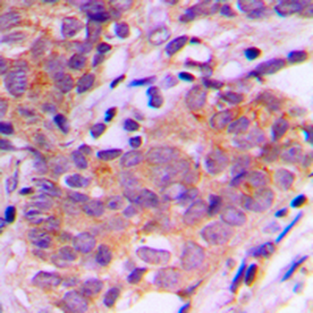 SGK1/2 Antibody