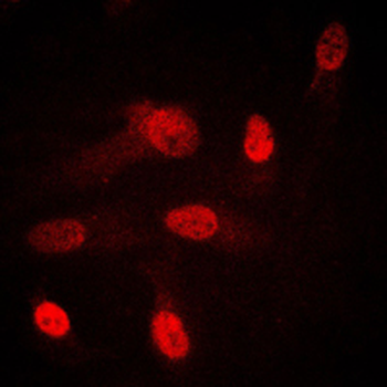 SGK1/2 Antibody