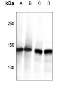 CLIP1 Antibody