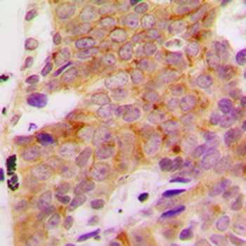 S6K1 (pS418) Antibody