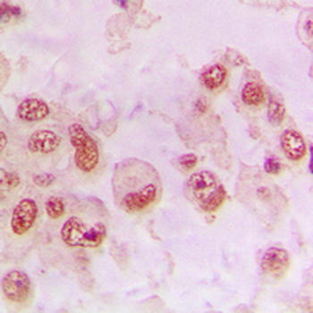 RAD23B Antibody