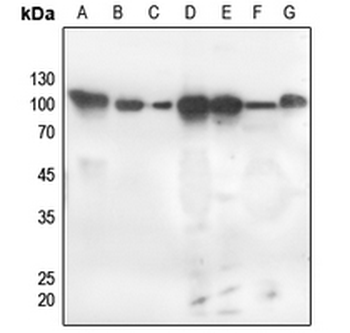 PKC zeta (pT560) Antibody