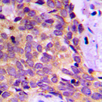PRKAR1B Antibody