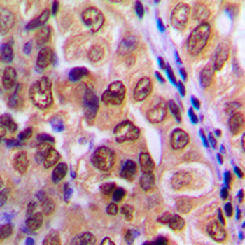 PKA C alpha/beta/gamma Antibody